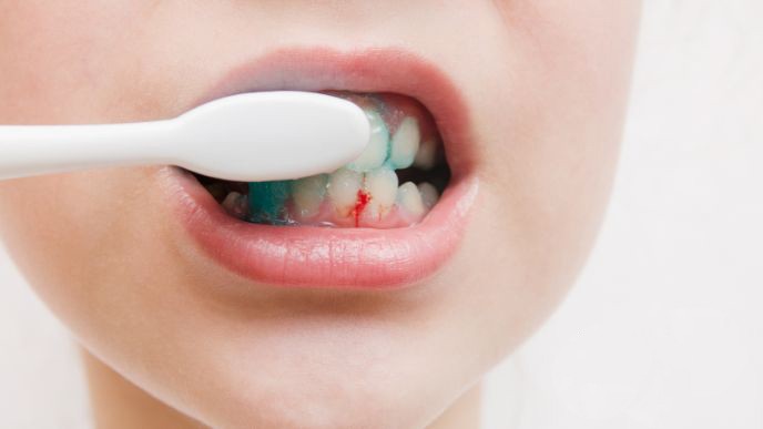 092909_es-normal-sangrar-al-cepillarse-los-dientes-senales-de-enfermedad-periodontal.jpg