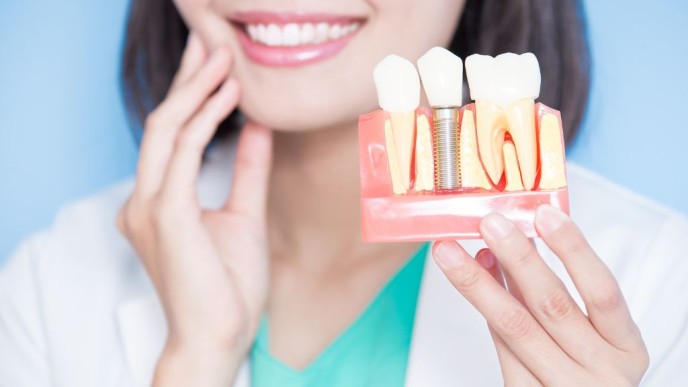Transforma tu sonrisa: Descubre la rehabilitación sobre implantes dentales