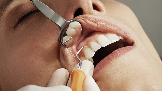 ¿Cómo se hace la estética dental?