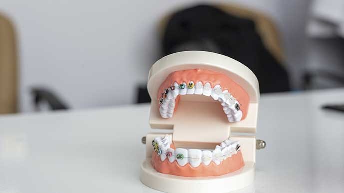 Mejores aparatos de ortodoncia