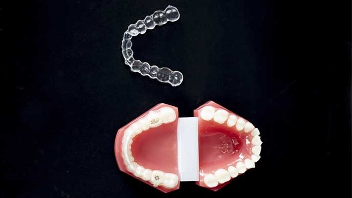 Ortodoncia removible ¿Que es y ventajas?
