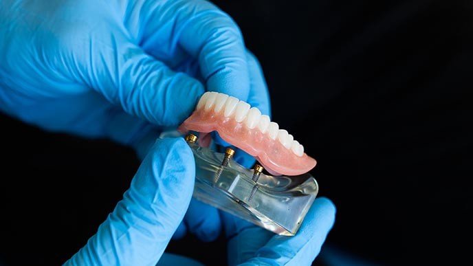 ¿Qué es un laboratorio dental?