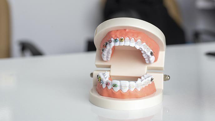 ¿Soy demasiado mayor para la ortodoncia?