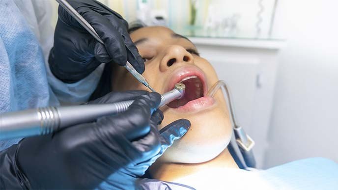 ¿Cuándo se hace una periodoncia?