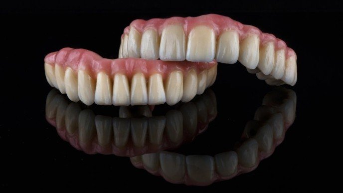 Prótesis dental fija sin implantes: Innovaciones en odontología