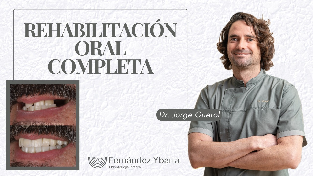 Video 2 de Rehabilitación oral completa